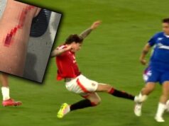 OSTALA MU RUPA NA NOZI, A SUDIJA UOPŠTE NIJE REAGOVAO! Fudbaler pokazao povredu nakon brutalnog starta igrača Mančester junajteda PeOVPyQJ