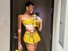 GLEDALI JE SA ZGRAŽAVANJEM, KINJILI ZBOG IZGLEDA A ONA UZELA MILIONE KAO MODEL! Pokušala da se ubije, pa postala NAJPOŽELJNIJA manekenka i zavela NBA zvezdu 5lDOZNV8