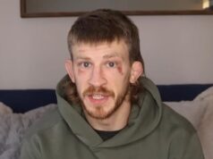 MMA BORAC ŽESTOKO ISPREBIJAN NA ULICI! Iz bizarnog razloga dobio ozbiljne batine – sav je u modricama i podlivima! Oglasio se i otkrio šta se desilo! FOTO Ronda Rauzi bivša UFC šampionka