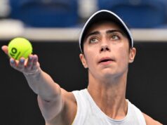 IMAM HRONIČAN PROBLEM SA KOLENOM“ Olga Danilović otkrila kroz šta prolazi: „Naučila sam za koji bol se pali lampica! beL0Q97e