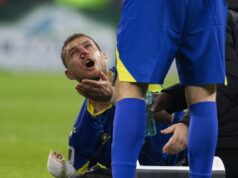 HOROR! Džeko objavio fotografiju posle jezive povrede nosa: Izgleda kao da je izašao iz ringa, a ne sa terena! (FOTO) RJzaW2ql