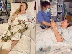 LINDZI VON OBJAVILA PRVE FOTOGRAFIJE IZ BOLNICE: Skijašica posle horor pada operisana i treći put Lindzi Von