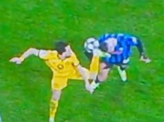 NIKOLA DOBIO STRAVIČAN UDARAC KOPAČKOM U GLAVU! Krstović objavio fotografije iz bolnice – pogledajte kako izgleda! Ostaće gadni ožiljci! (FOTO, FOTO) Nikola Krstović
